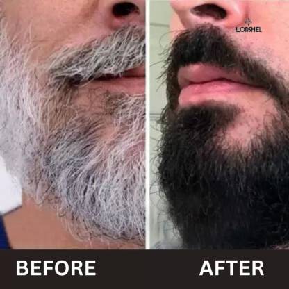 4491